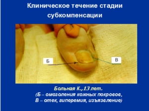 пояснение текста